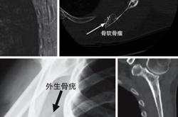 背痛翻译
