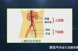 尿路感染的日语