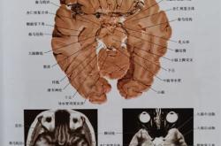 其两膝相比者句式