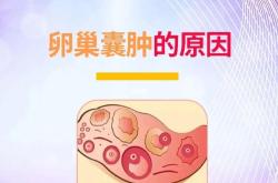 卵巢囊肿的形成原因
